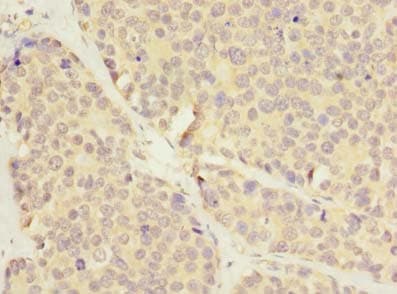 LRRC8E Antibody (aa353-630)