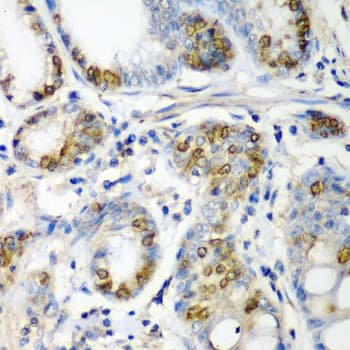 CRYAA / Alpha A Crystallin Antibody