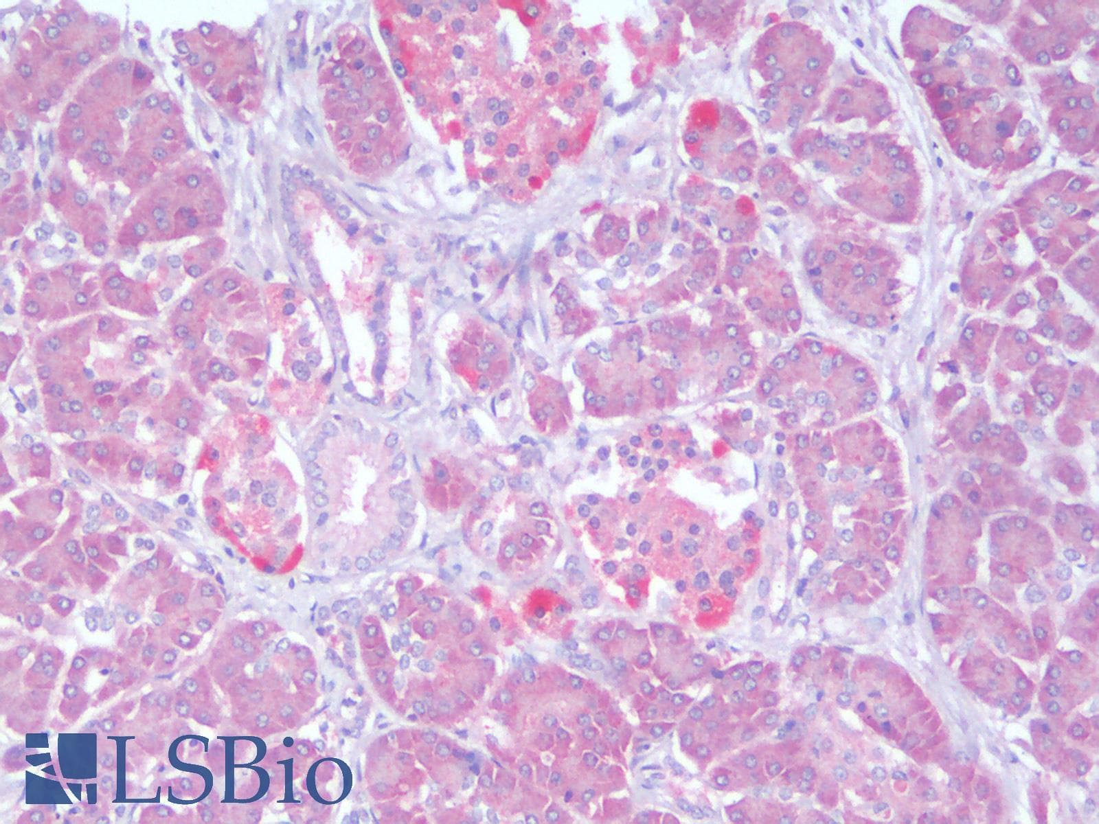 PathPlus™ Polyclonal Rabbit anti-Human PIK3CA / PI3K Alpha Antibody (IHC)