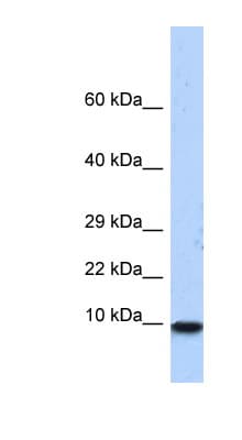 PCBD1 / PHS Antibody (N-Terminus)