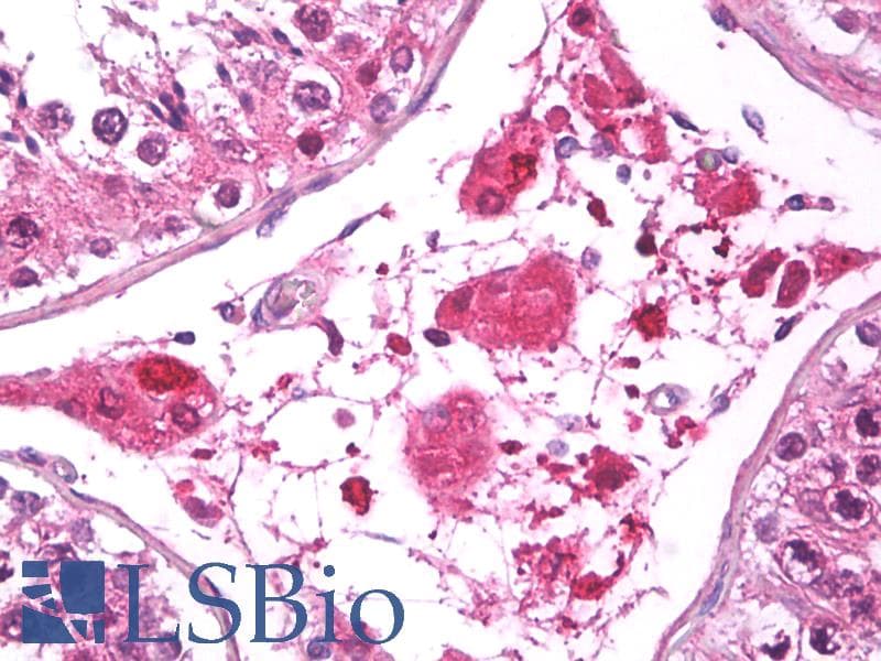 IHC-plus™ Monoclonal Rabbit anti-Human FABP3 / H-FABP Antibody (clone EPR6127, Internal, IHC, WB)