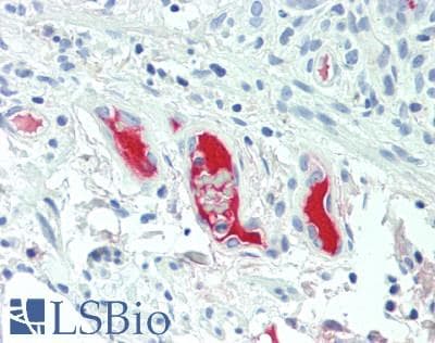 Complement C4b Antibody (aa680-756)