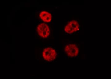HOXA9 Antibody