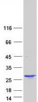 Human TAGLN3 / Neuronal Protein 22 (Recombinant Myc-DDK (Flag))