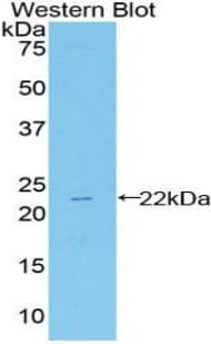 HSPB2 / HSP27 Antibody (aa12-170, Biotin)