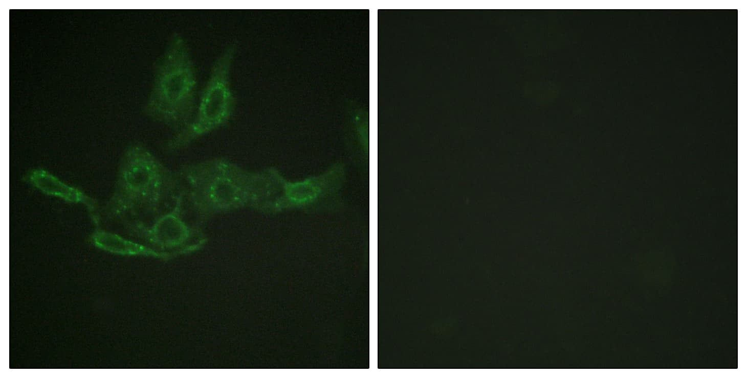 IHC-plus™ BCL2 / Bcl-2 Antibody (aa46-95)