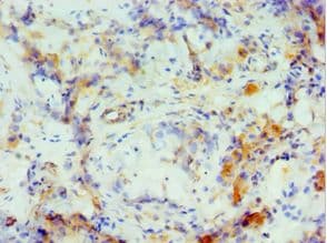 CRISP2 / TSP1 Antibody (aa22-243)