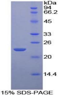 Mouse CD79A / CD79 Alpha Protein (Recombinant His-T7)