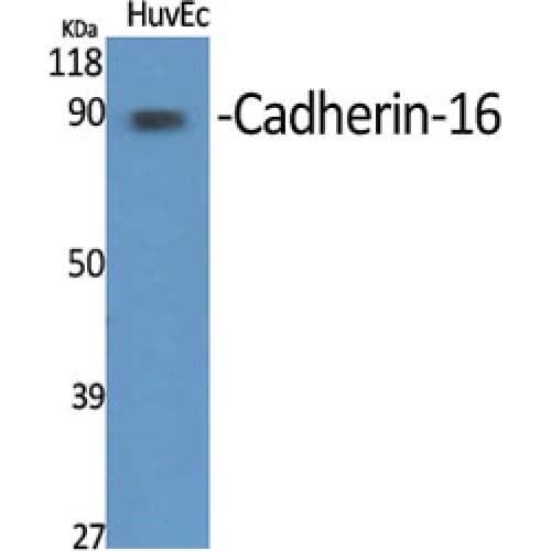 Polyclonal Rabbit anti-Human CDH16 / Cadherin 16 Antibody (750-830 aa, C-terminal, IHC, IF, WB)