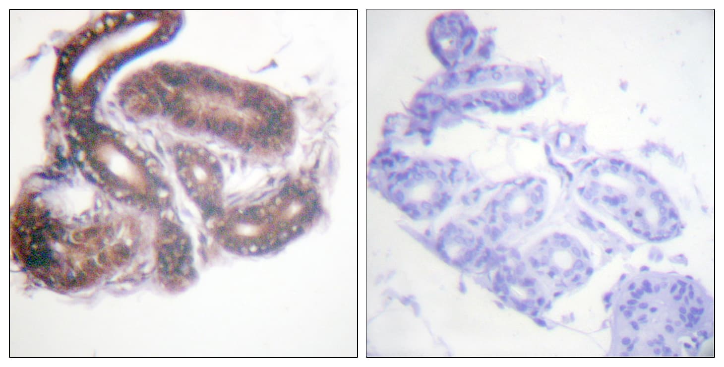 Polyclonal Rabbit anti-Human HDAC3 Antibody (aa379-428, IHC, IF, WB)