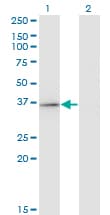 RFXAP Antibody (clone 1B5)