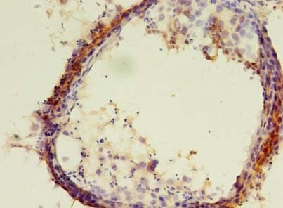 Polyclonal Rabbit anti-Human ERLIN1 / SPFH1 Antibody (IHC, WB)