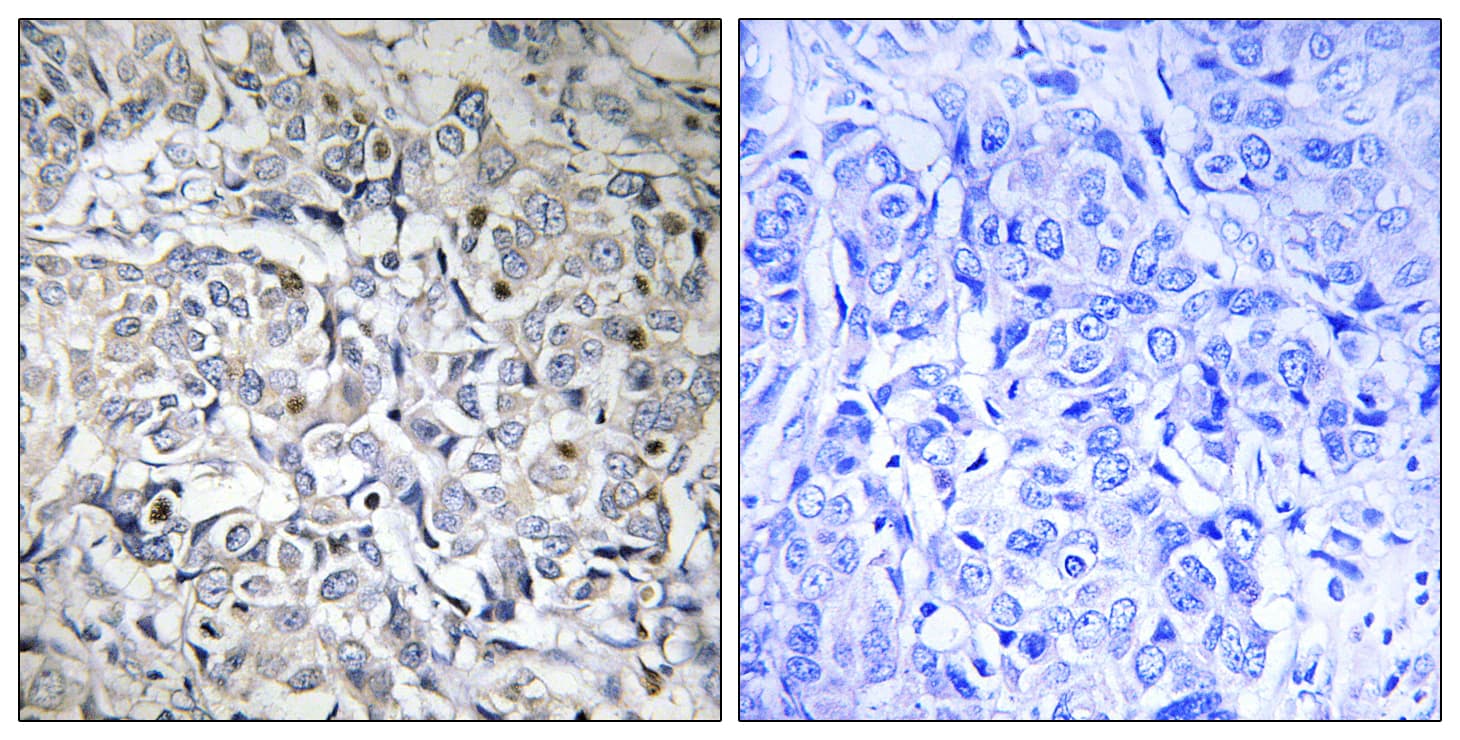 RELA / NFKB p65 Antibody (phospho-Thr505)