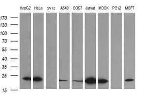 Monoclonal Mouse anti-Human LZIC Antibody (clone OTI1D5, IHC, WB)