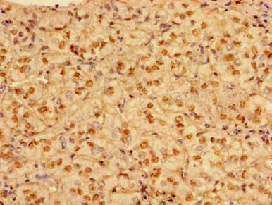 Polyclonal Rabbit anti-Human PRMT1 Antibody (IHC, WB)