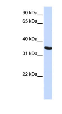 DPPA2 Antibody (aa36-85)
