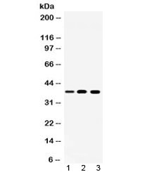 LDHA / LDH1 Antibody