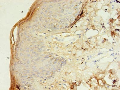 TM4SF6 / TSPAN6 Antibody