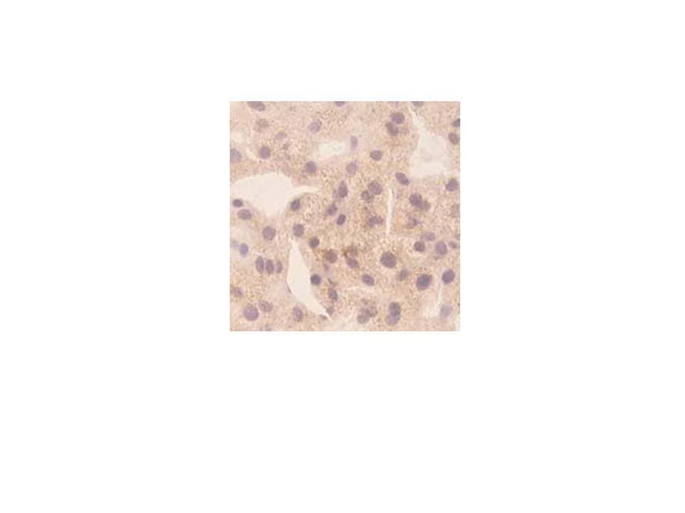 CXCL10 / IP-10 Antibody (clone 1)