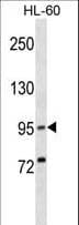 Polyclonal Rabbit anti-Human XPR1 Antibody (aa96-122, WB)