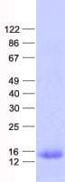 Human TRAPPC6B Protein (Recombinant His, N-Terminal)