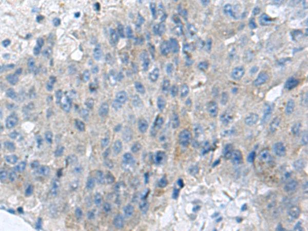 KIAA0556 Antibody