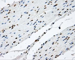 NIT2 Antibody (clone OTI6H7)