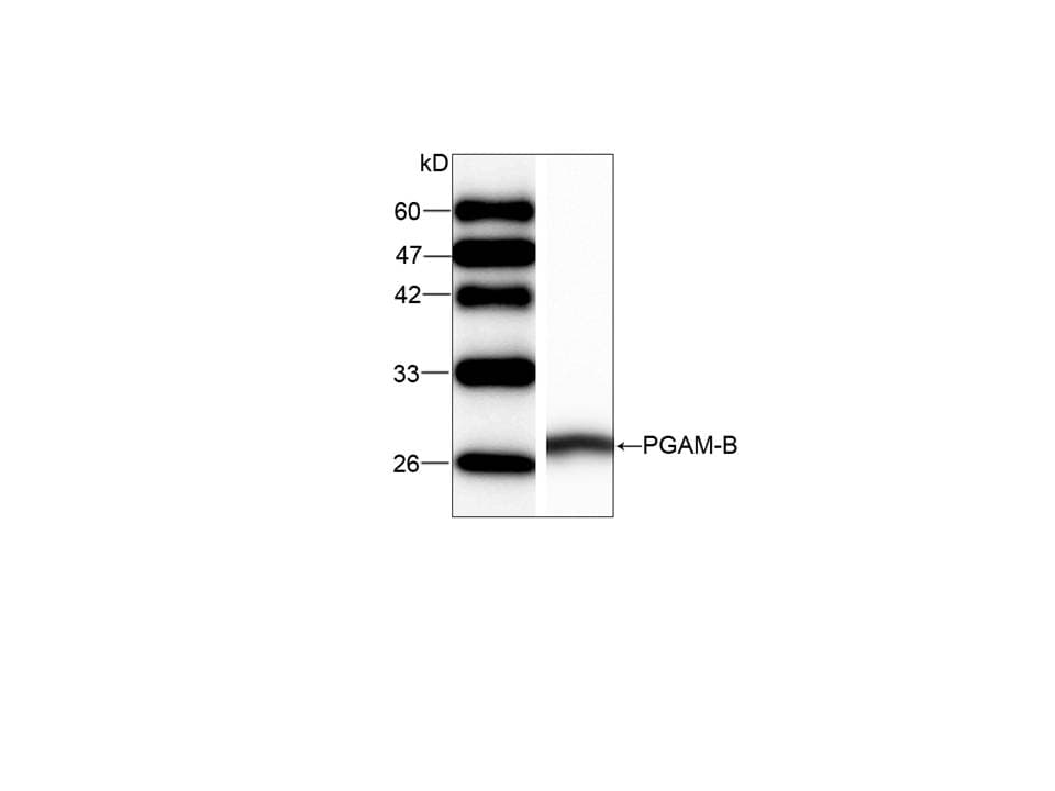 IHC-plus™ Monoclonal Mouse anti-Human PGAM1 Antibody (IHC, WB)