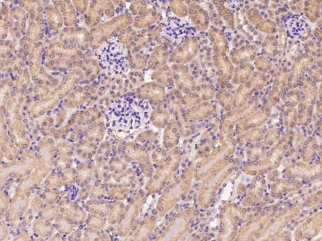 CDC25B Antibody