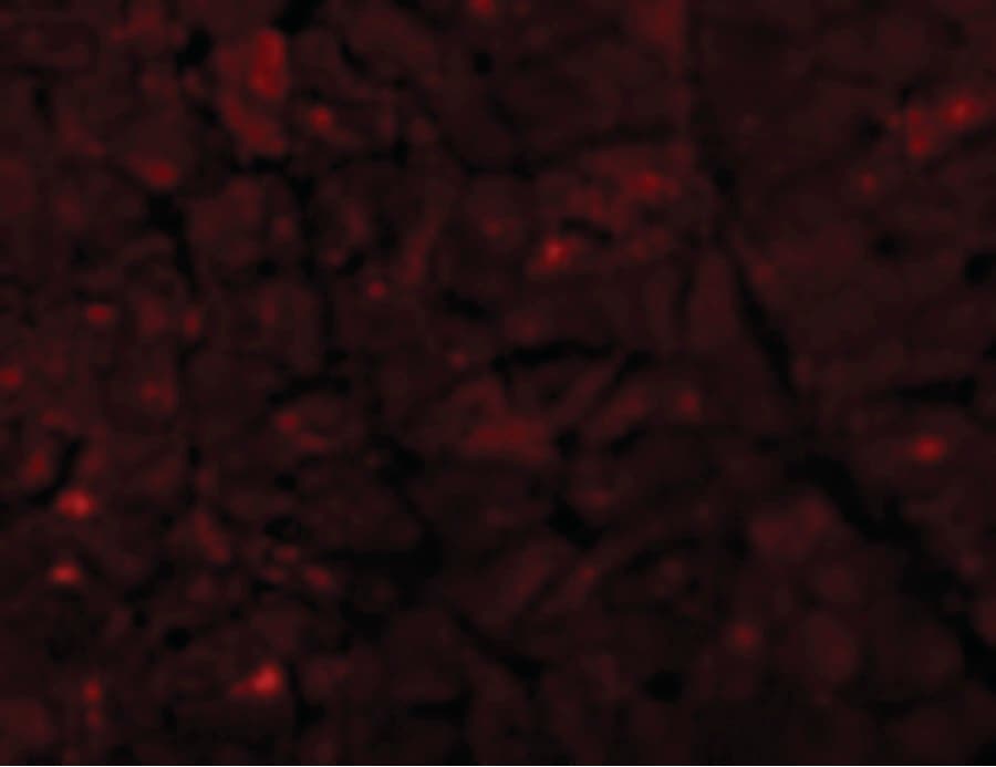 PathPlus™ Polyclonal Rabbit anti-Human CASP12 / Caspase 12 Antibody (IHC, IF, WB)