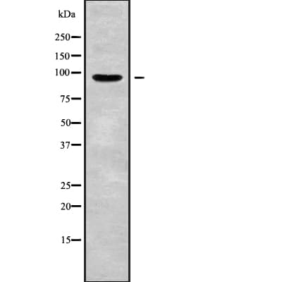 GRM2 / MGLUR2 Antibody