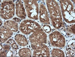MAP2K1 / MKK1 / MEK1 Antibody (clone OTI7E2)