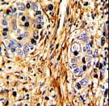 LAMB2 / Laminin Beta 2 Antibody (aa1579-1606)