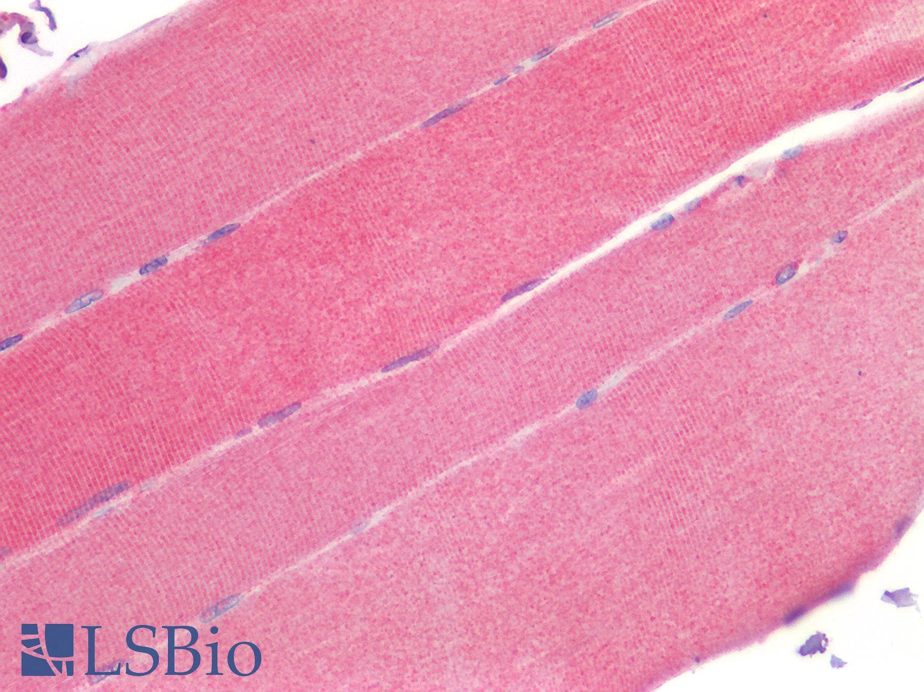 IHC-plus™ RORC / ROR Gamma Antibody (Ligand-binding Domain)