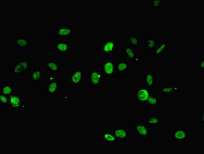 IHC-plus™ Polyclonal Rabbit anti-Human RPA2 / RFA2 / RPA34 Antibody (IHC, WB)