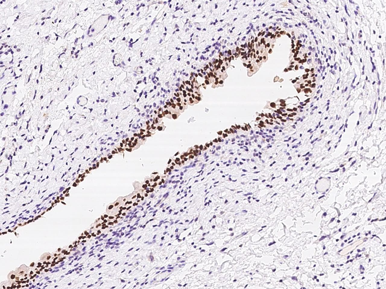 Polyclonal Rabbit anti-Human FOXA1 Antibody (IHC, IF)