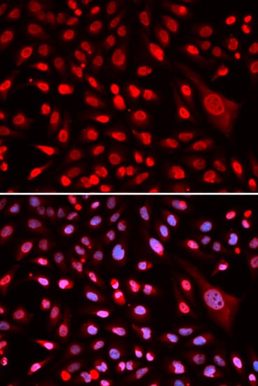 Polyclonal Rabbit anti-Human CBFB Antibody (IHC, IF, WB)