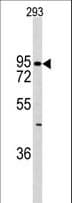 CDH6 / K Cadherin Antibody (aa665-695)