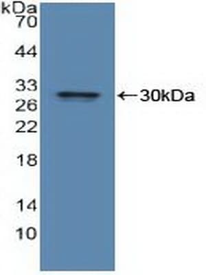 IDE Antibody (aa753-973)