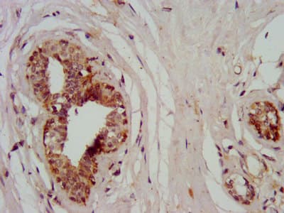 SMMHC / MYH11 Antibody