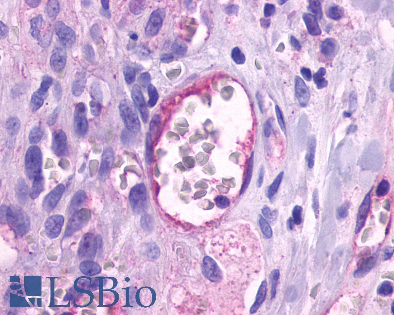 IHC-plus™ Polyclonal Rabbit anti-Human ADGRA2 / GPR124 Antibody (N-Terminus, IHC)