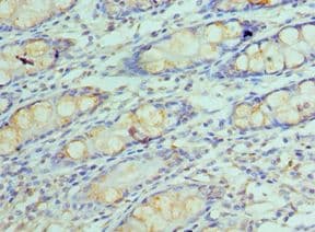 GOLM1 / GP73 / GOLPH2 Antibody (aa112-401)