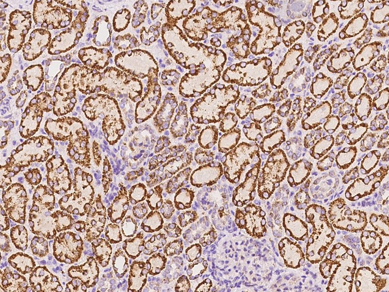 Polyclonal Rabbit anti-Human VEGF 121 Antibody (Preservative Free, IHC, IF)