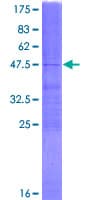 Human GLOD2 / MCEE Protein (Recombinant GST)