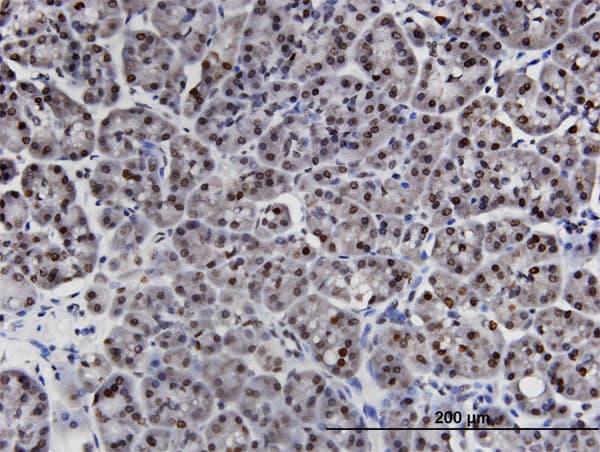 LIMD1 Antibody (clone 2G5)