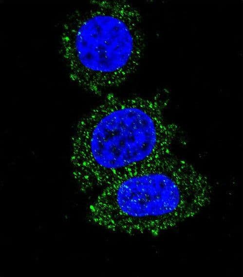 Monoclonal Mouse anti-Human AKT2 Antibody (aa214-451, IHC, IF, WB)