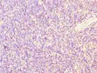Polyclonal Rabbit anti-Human SFXN4 Antibody (IHC, WB)