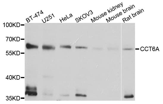 Polyclonal Rabbit anti-Human CCT6A Antibody (IHC, WB)