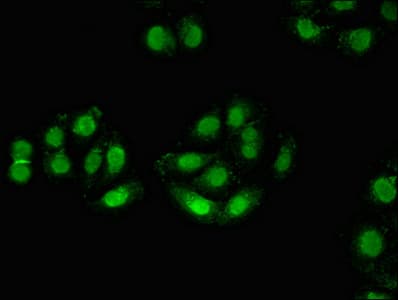 Polyclonal Rabbit anti-Human ZMYM3 Antibody
