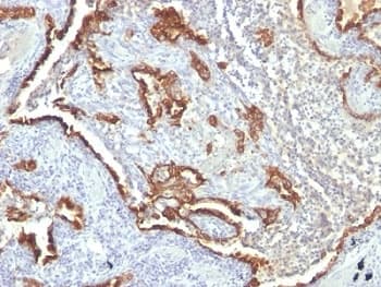 KRT7 / CK7 / Cytokeratin 7 Antibody (clone KRT7/760 + OV-TL12/30)